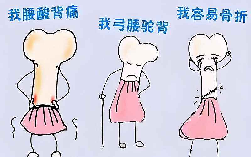 哪些人需要做骨密度檢測(cè).jpg